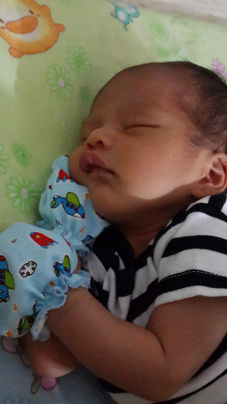 Fergie 1Mo