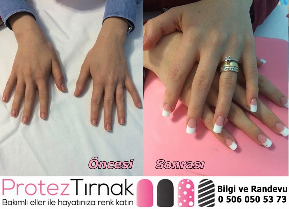 Izmir Protez Tirnak Izmir Protez Tirnak