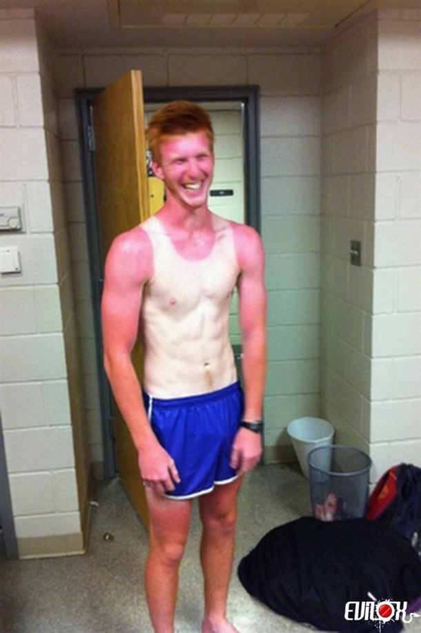 14 marcas de sol tão bizarras que faria você ter vergonha de sair na rua