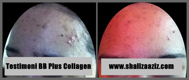 testimoni BB Plus Collagen, tips hilangkan parut jerawat, parut, jerawat