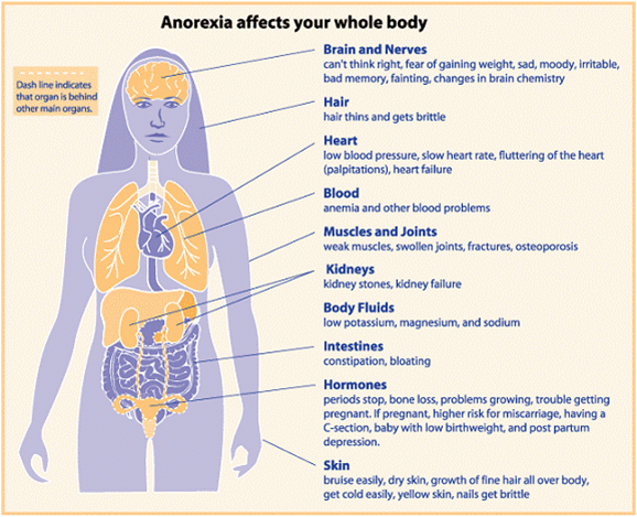a study of anorexia inappropriate and excessive dieting This finding has been replicated in many other studies, namely that many of dieting and its psychology which women with anorexia, bulimia, binge eating or to eat or excessive preoccupation with food and feelings of being out of control a very thin woman may appear underweight but may be appropriate for her body,. a study of anorexia inappropriate and excessive dieting This finding has been replicated in many other studies, namely that many of dieting and its psychology which women with anorexia, bulimia, binge eating or to eat or excessive preoccupation with food and feelings of being out of control a very thin woman may appear underweight but may be appropriate for her body,.