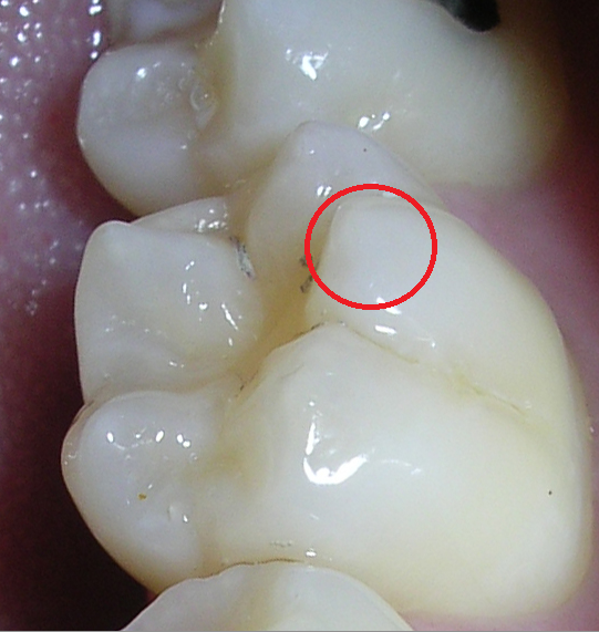 Anatomia Dental hola doctora cuevas! en esta imagen se muestra la