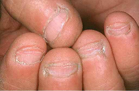 Stop Nail Biting And Thumb Ing Mavala S Nails Mavala Amazing Stop Nail Biting Product