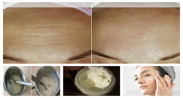 Anti-Aging Homemade Cream to Get Rid of Lines and Wrinkles on Your Face in Less Than Two Weeks Anti-Aging Homemade Cream to Get Rid of Lines and Wrinkles on Your Face in Less Than Two Weeks
