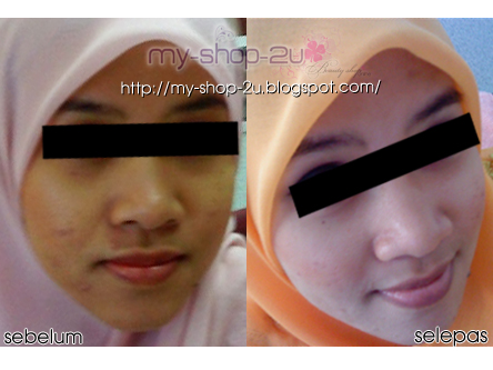 Home Artis Bugil Cerita Panas Cerita Sex Lain-Lain Sedarah Sex Umum