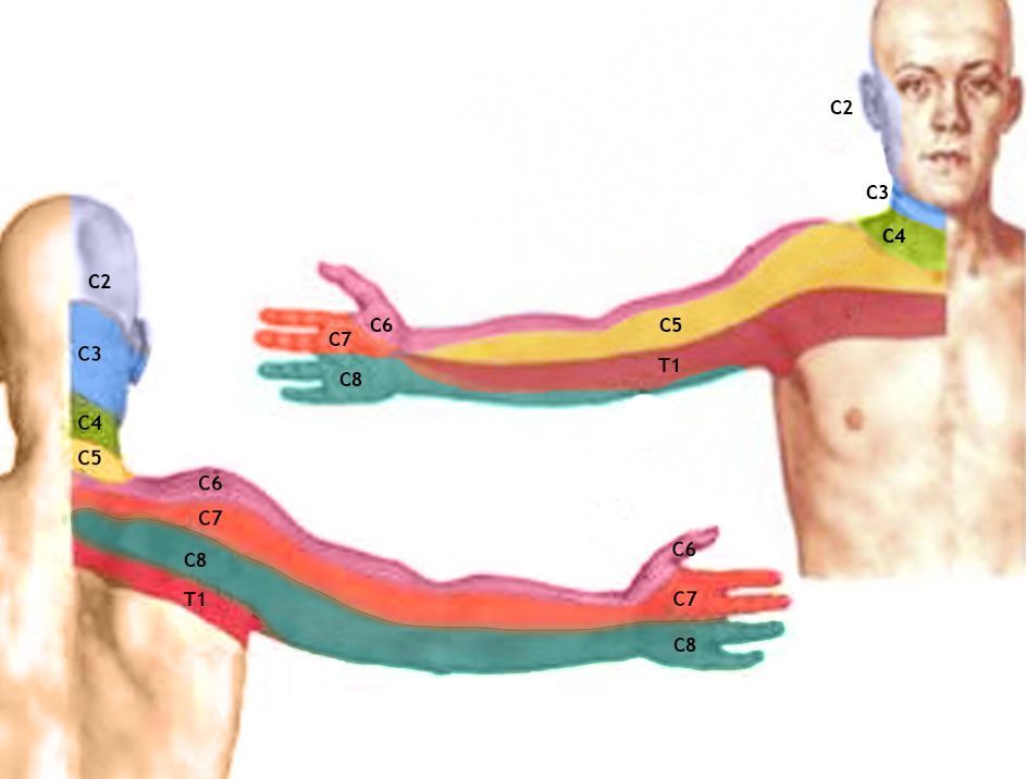 Hernia discal In Motion