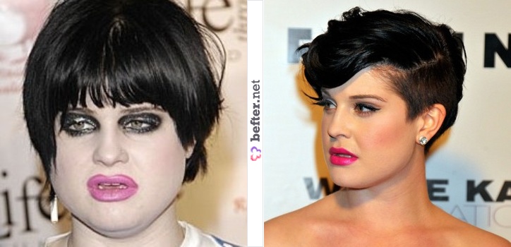 kelly osbourne before and after. fat celebs