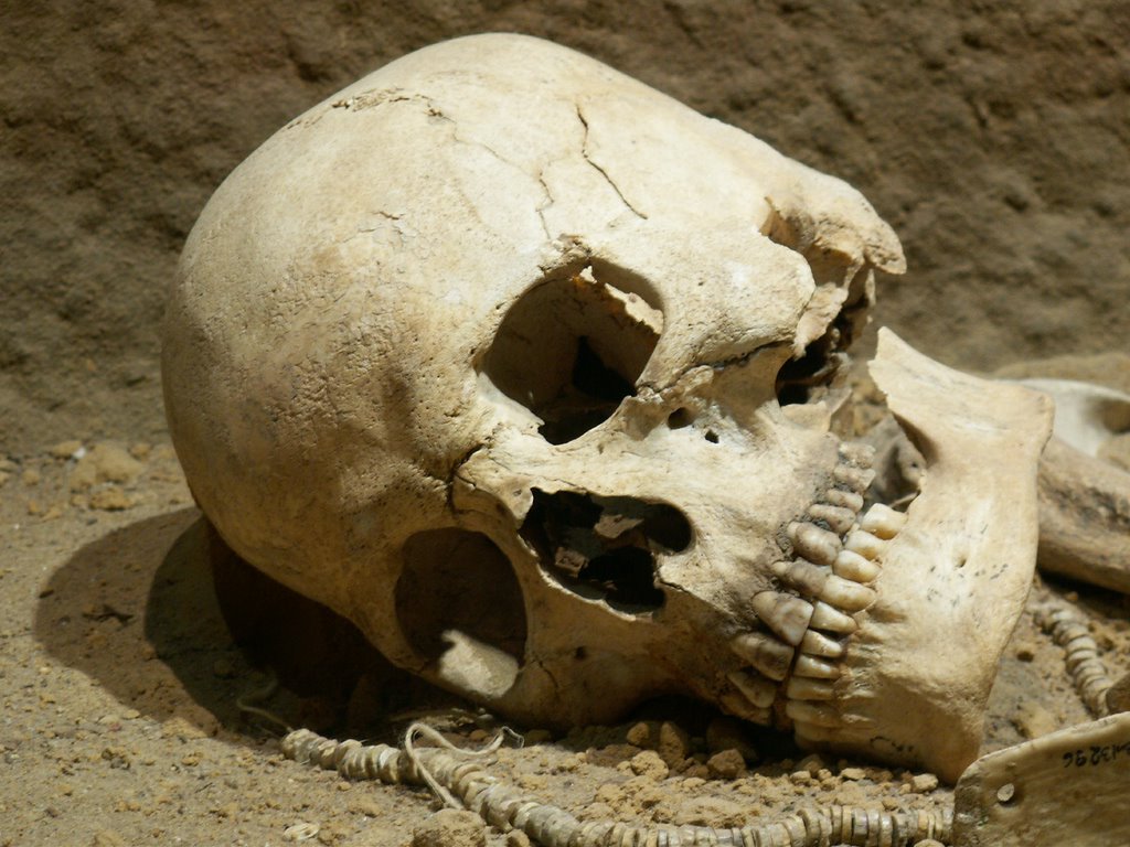human skull back