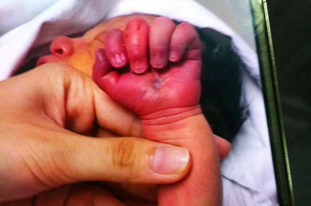 Cannibal Mum Tries To Eat Her Own Baby Shortly After Giving Birth 2 Cannibal Mum Tries To Eat Her Own Baby Shortly After Giving Birth