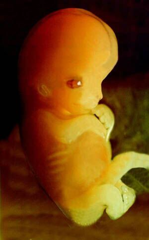Yellow discharge at 37 weeks? TMI.