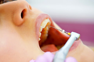 ¿QUÉ ES LA ENDODONCIA? ¿QUÉ ES LA ENDODONCIA?