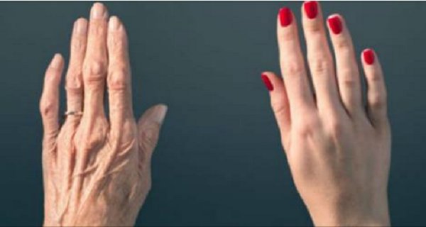 Your Hands Reveal Your Age! Here’s How To Stop That! Your Hands Reveal Your Age! Here’s How To Stop That!