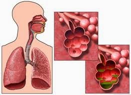 obat radang paru herbal obat radang paru herbal