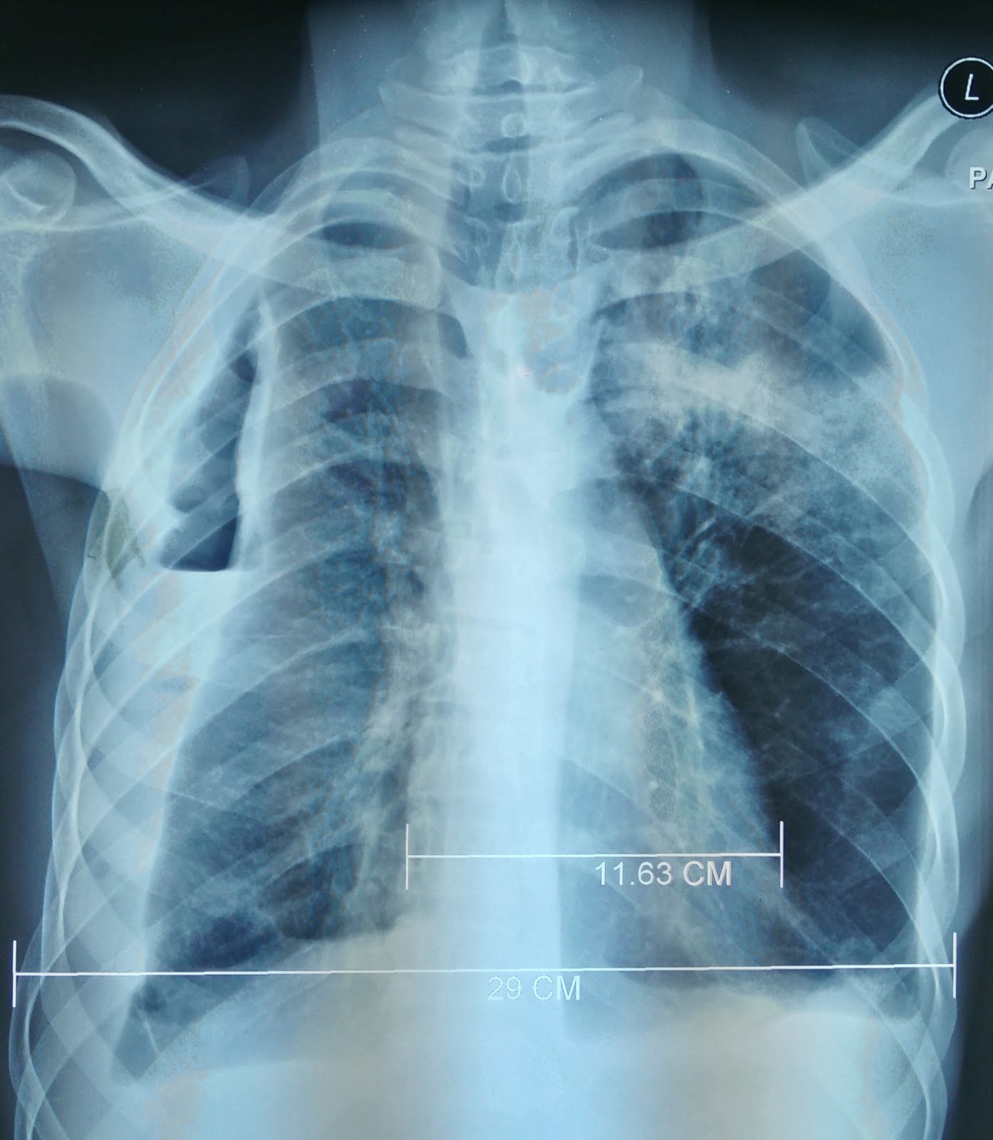 The Place of the Wind