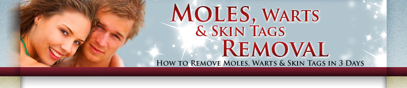 Now remove your skin tags