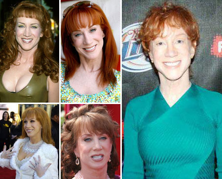 kathy-griffin-plastic-surgery-before-and