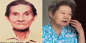Mati tertelan gigi palsu