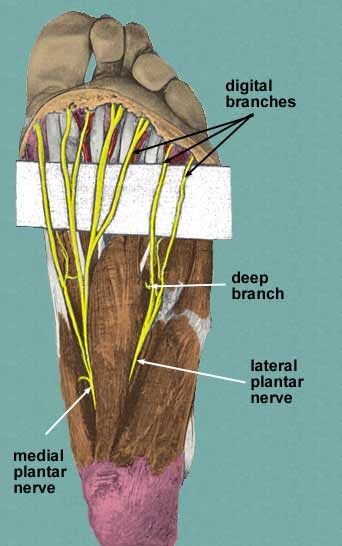 Doctors Gates: Common sites for Morton's neuromas