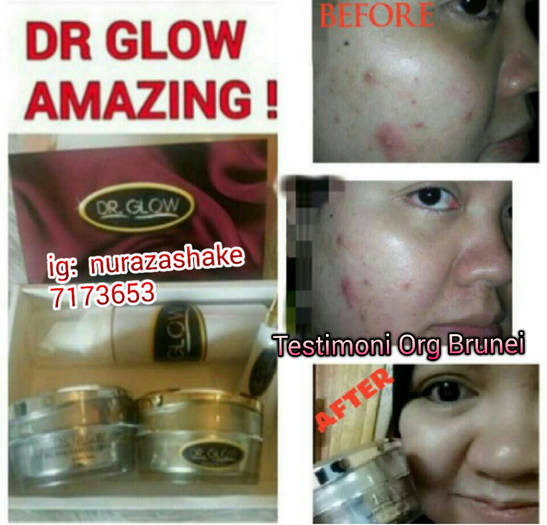 Nurazashake Mini Shop Testimoni Orang Brunei gunakan Dr Glow SkinCare