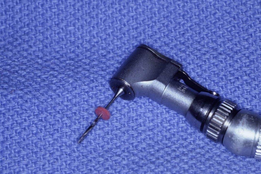 Dentistry Custom Cast Dowel Core