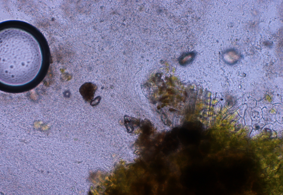 University of Illinois Plant Clinic The Difference Between Bacterial