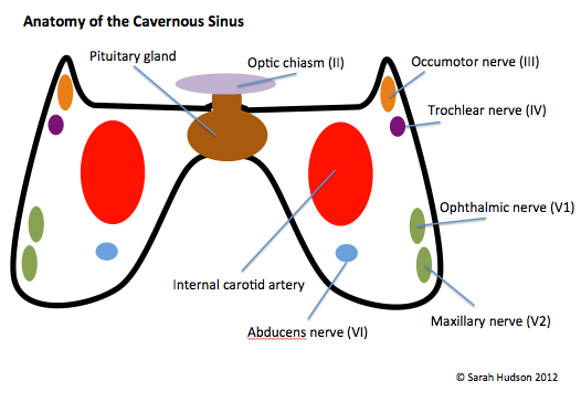 cavernous sinus thrombosis