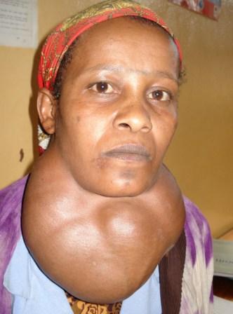 the snake basket neck