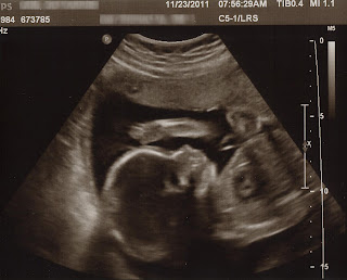 24 week ultrasound