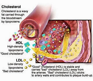 High Blood Cholesterol Causes, Symptoms, Diagnosis ...