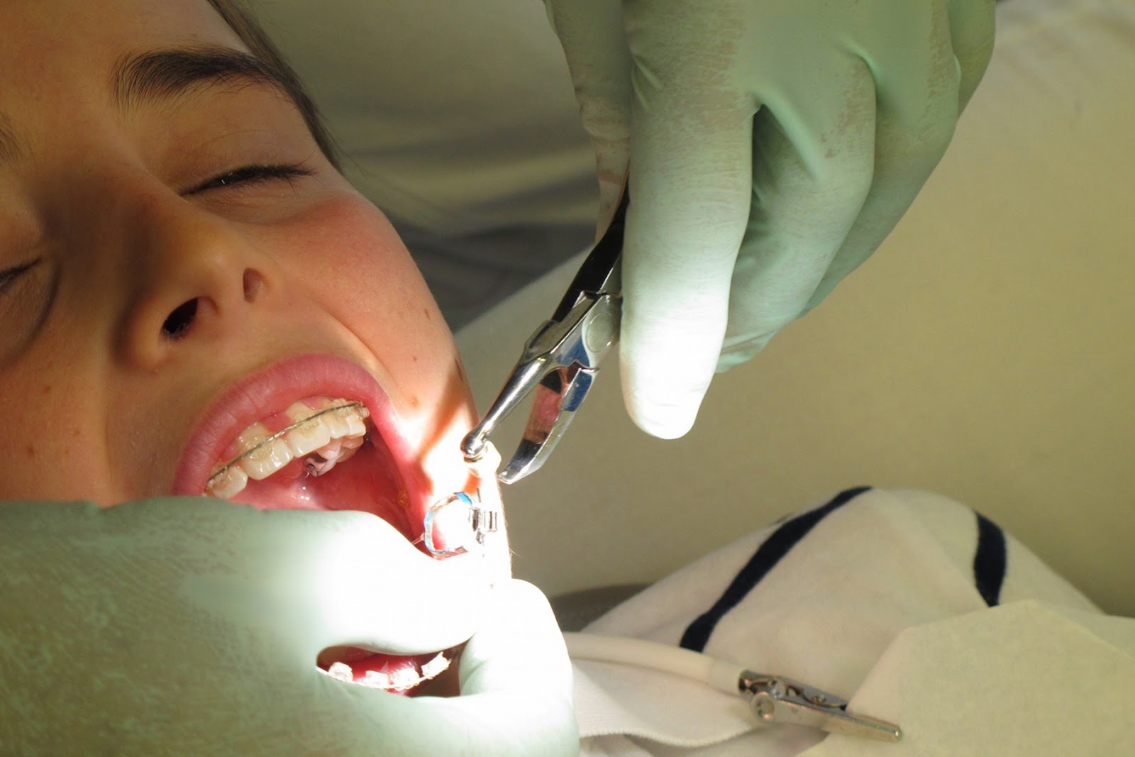 daily doings the boy "lost" his braces