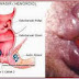 Obat Ambeien Apotik thumbnail