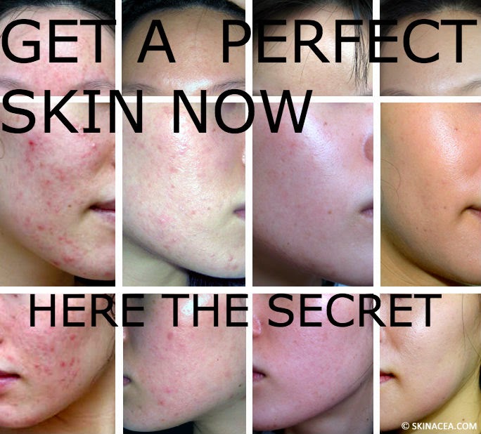 Skin Peels Secrets