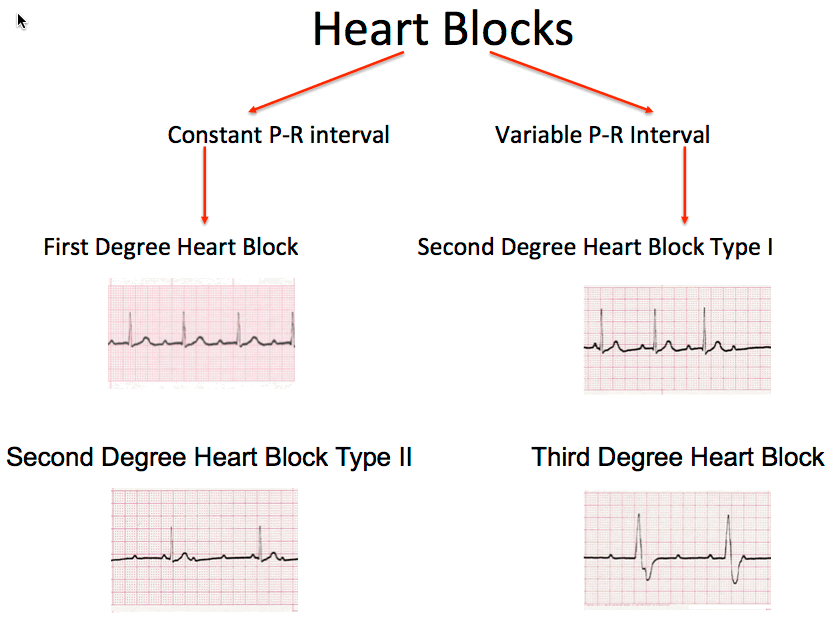LymeMD Lyme, the heart and simple screening and monitoring