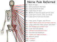 Stomach Pain Diagram Stomach Pain Diagram