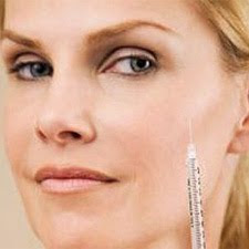 Amy Brenneman Botox Implants