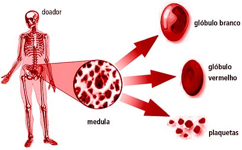 IMAGENES DE NINOS CON LEUCEMIA imagenes de ninos con leucemia: