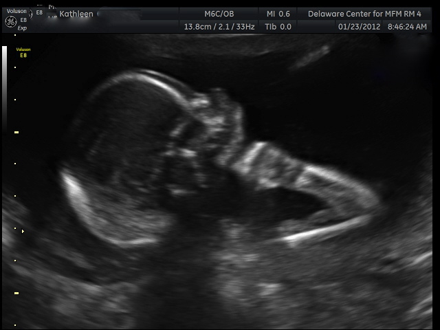 2028 summer olympics review