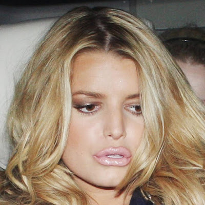 Jessica Simpson Plastic Surgery