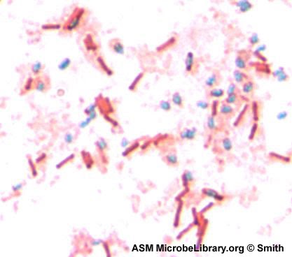 Pewarnaan Bakteri/ Mikroorganisme ~ Artikel Teknik Kimia