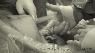 BABY GRABS DOCTOR'S FINGER WHILE STILL IN WOMB