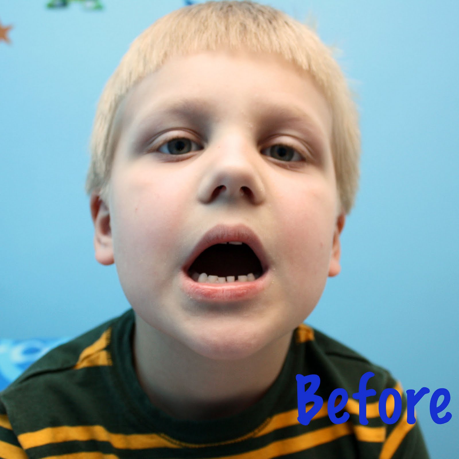 Wyatts First Lost Tooth Wyatts First Lost Tooth