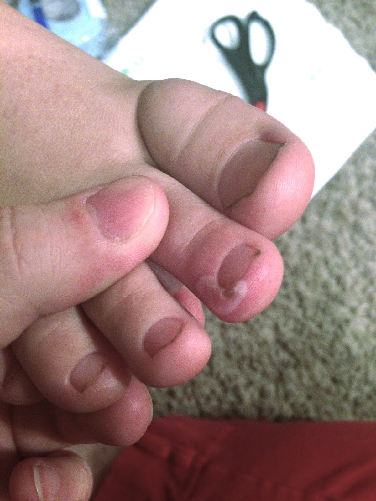 Leukemia Just a Fork In Our Road Sad Feet