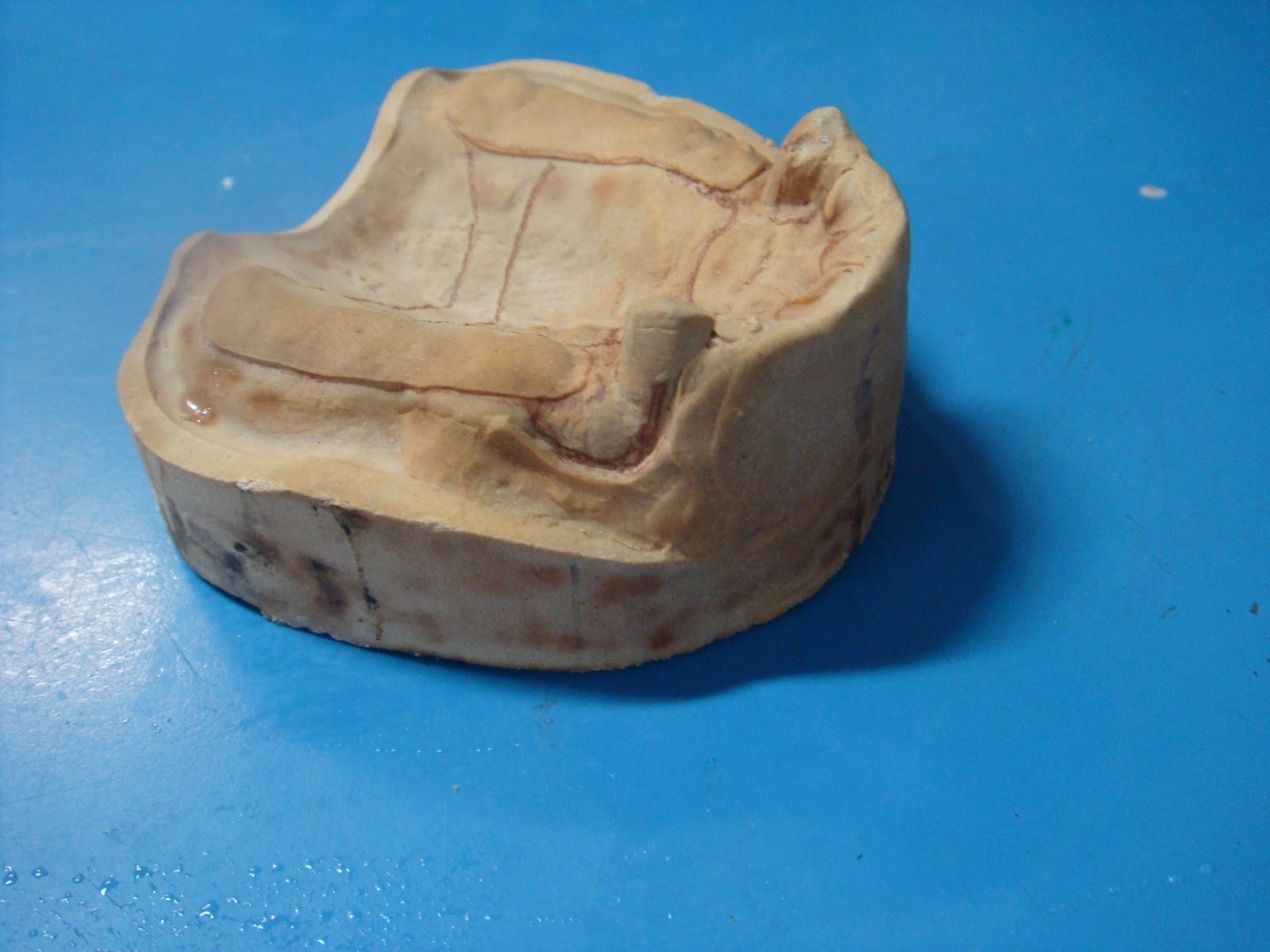 Step by step Guide for Understanding the Prosthodontics A step by step