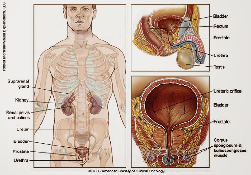 Obat Tradisional Kanker Prostat Yang Efektif Obat Tradisional Kanker Prostat Yang Efektif