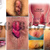 Pusat Pengobatan Wasir Tradisional Ambeclear thumbnail