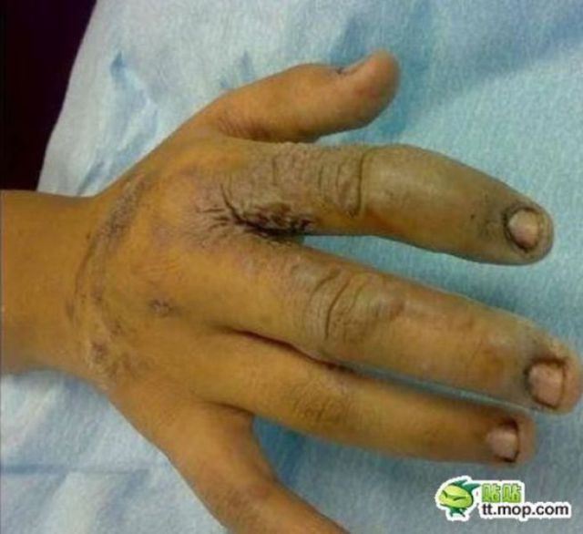 Αναρτημένη εικόνα