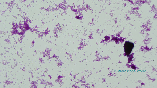 Microscopy image of Diphtheria bacteria.