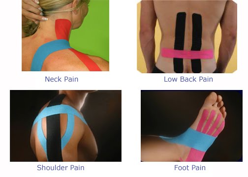 What is the Kinesio taping technique?