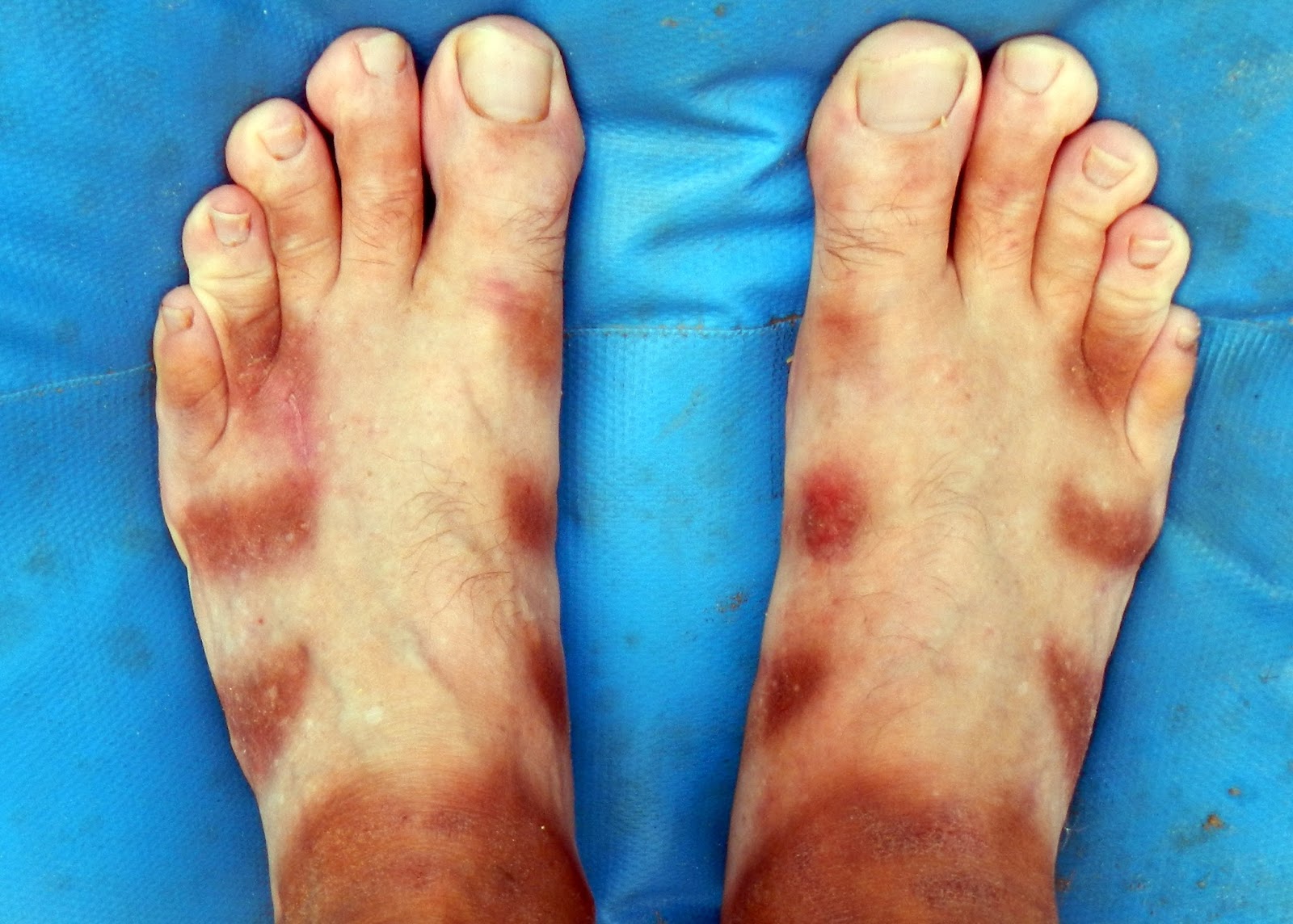 keen feet