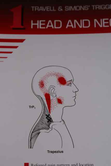 cornerstone therapies july 2011 travell and simons trigger point flip charts